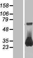RAB26 Human Over-expression Lysate