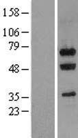 Nucleostemin (GNL3) Human Over-expression Lysate