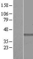 MICS1 (GHITM) Human Over-expression Lysate