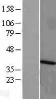 ANKRD1 Human Over-expression Lysate