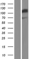 SND1 Human Over-expression Lysate