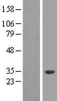 SND1-IT1 Human Over-expression Lysate