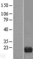 TRAPPC3 Human Over-expression Lysate