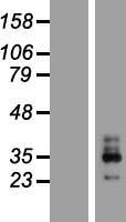 KCNMB3 Human Over-expression Lysate