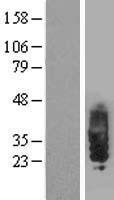 SIT (SIT1) Human Over-expression Lysate
