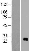 IL17B Human Over-expression Lysate