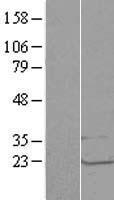 LSM1 Human Over-expression Lysate