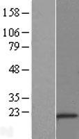CSDC2 Human Over-expression Lysate