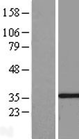 DIMT1L (DIMT1) Human Over-expression Lysate