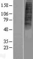 P2Y10 (P2RY10) Human Over-expression Lysate