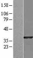 SULT1B1 Human Over-expression Lysate