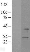 Tropomodulin 2 (TMOD2) Human Over-expression Lysate