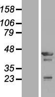 Tropomodulin 3 (TMOD3) Human Over-expression Lysate