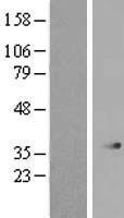 SERHL2 Human Over-expression Lysate