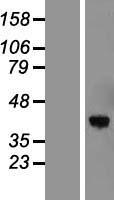 Torsin B (TOR1B) Human Over-expression Lysate