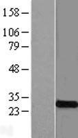 KCNMB4 Human Over-expression Lysate