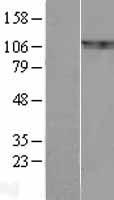 BCAR1 Human Over-expression Lysate
