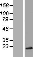 TRAPPC2 Human Over-expression Lysate