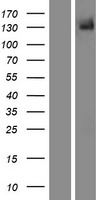 TRPM5 Human Over-expression Lysate