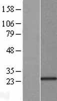 KCNIP1 Human Over-expression Lysate