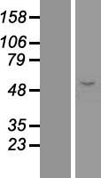 ERO1L (ERO1A) Human Over-expression Lysate