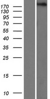 Proteasome Activator Subunit 4 (PSME4) Human Over-expression Lysate