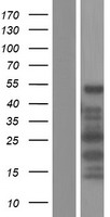 CDRL2 (CDR2L) Human Over-expression Lysate