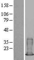 S100 alpha 6 (S100A6) Human Over-expression Lysate