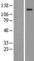 CTR9 Human Over-expression Lysate