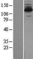 DZIP3 Human Over-expression Lysate