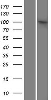 SAPS2 (PPP6R2) Human Over-expression Lysate