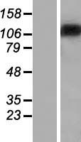 ST18 Human Over-expression Lysate