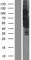 GARRE1 Human Over-expression Lysate