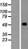 SNX17 Human Over-expression Lysate