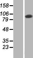 TATDN2 Human Over-expression Lysate