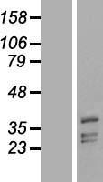 PHYHIP Human Over-expression Lysate