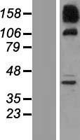 SNX19 Human Over-expression Lysate
