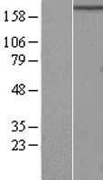 FIP200 (RB1CC1) Human Over-expression Lysate