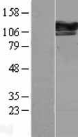 SEC24D Human Over-expression Lysate