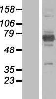 EPM2AIP1 Human Over-expression Lysate