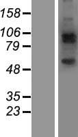 JAKMIP2 Human Over-expression Lysate