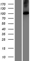 SPCA2 (ATP2C2) Human Over-expression Lysate