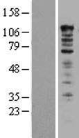 UBAP2L Human Over-expression Lysate