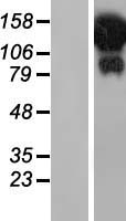HELZ Human Over-expression Lysate