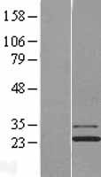 Josephin 1 (JOSD1) Human Over-expression Lysate