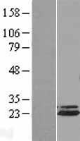 Apc10 (ANAPC10) Human Over-expression Lysate