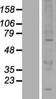 UBOX5 Human Over-expression Lysate