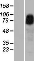 ANKRD6 Human Over-expression Lysate