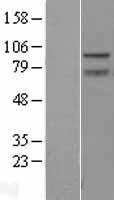 ZBTB5 Human Over-expression Lysate