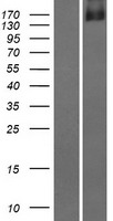 DIP2C Human Over-expression Lysate